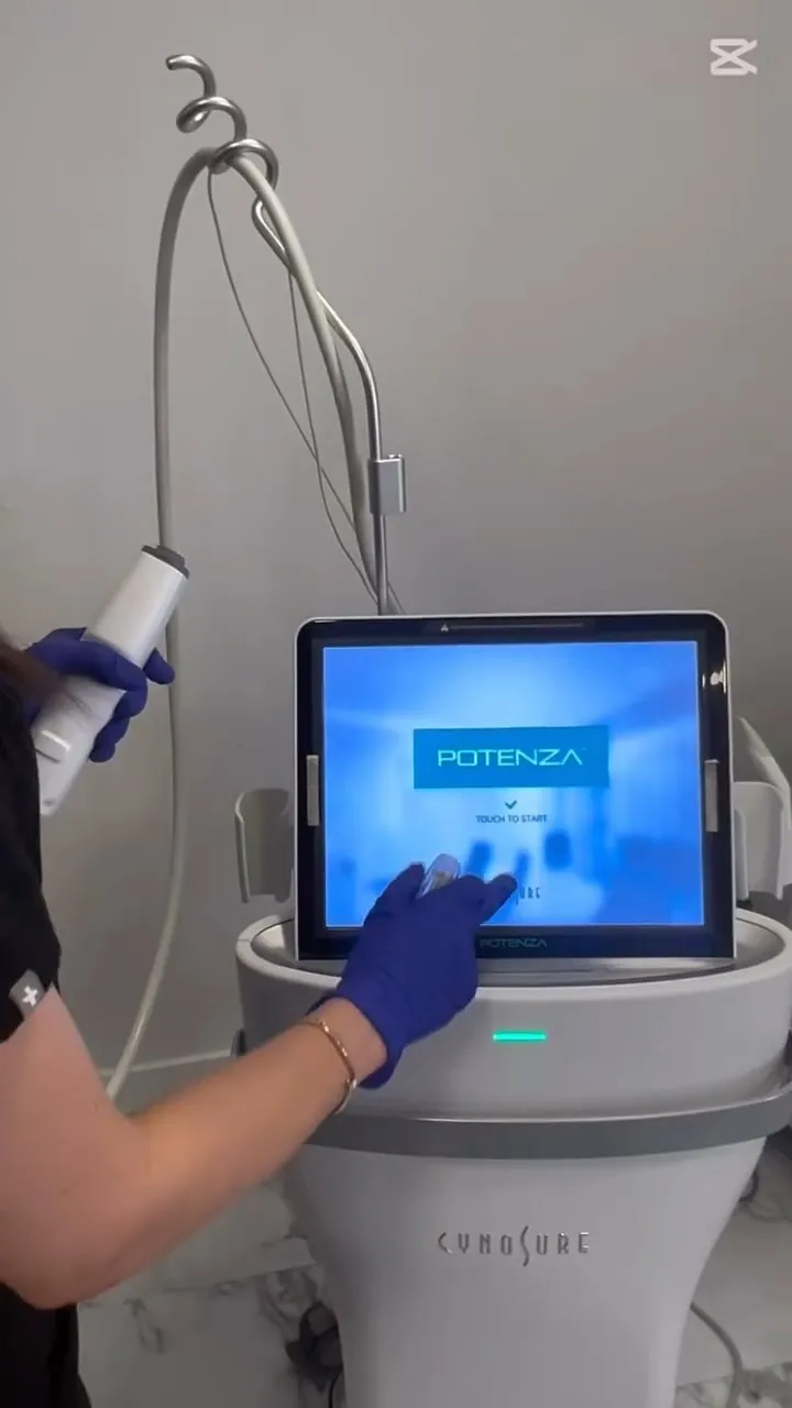 The Potenza radiofrequency microneedling device